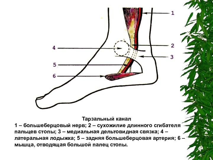 Тарзальный канал1 – большеберцовый нерв; 2 – сухожилие длинного сгибателя пальцев стопы;