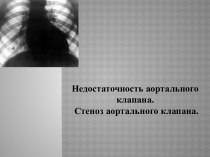 Недостаточность аортального клапана. Стеноз аортального клапана