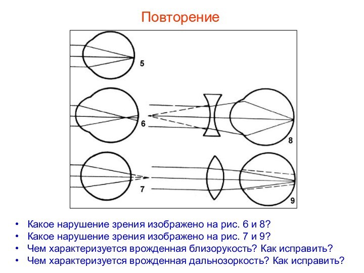 Какое нарушение зрения изображено на рис. 6 и 8? Какое нарушение зрения