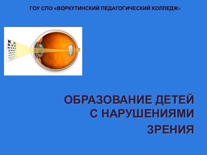 ОБРАЗОВАНИЕ ДЕТЕЙ С НАРУШЕНИЯМИ ЗРЕНИЯ ГОУ СПО «ВОРКУТИНСКИЙ ПЕДАГОГИЧЕСКИЙ КОЛЛЕДЖ»