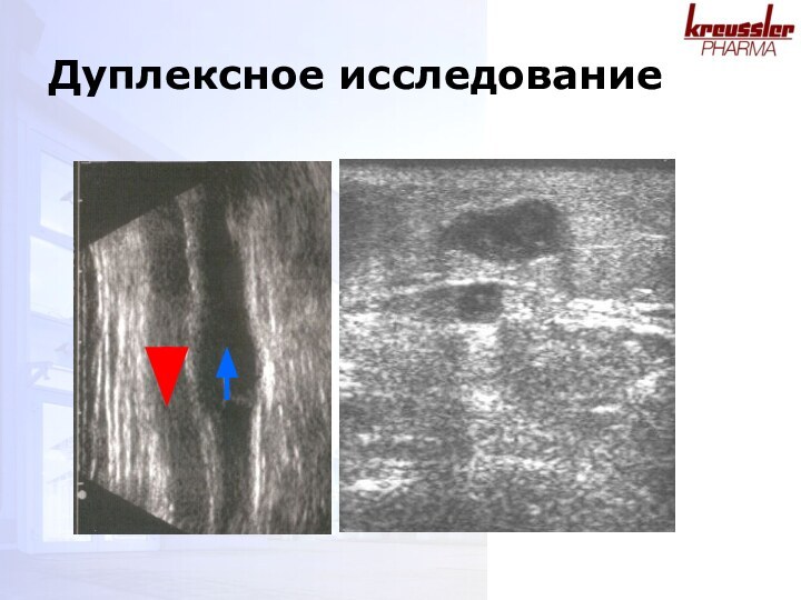 Дуплексное исследование