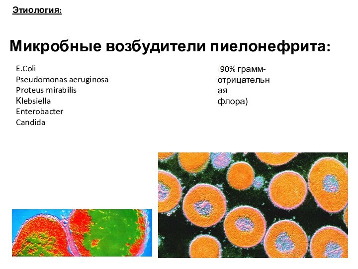 Микробные возбудители пиелонефрита:E.ColiPseudomonas aeruginosaProteus mirabilisКlebsiellaEnterobacterCandida(90% грамм-отрицательнаяфлора)Этиология: