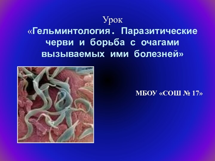 МБОУ «СОШ № 17»Урок «Гельминтология. Паразитические черви и борьба с очагами вызываемых ими болезней»