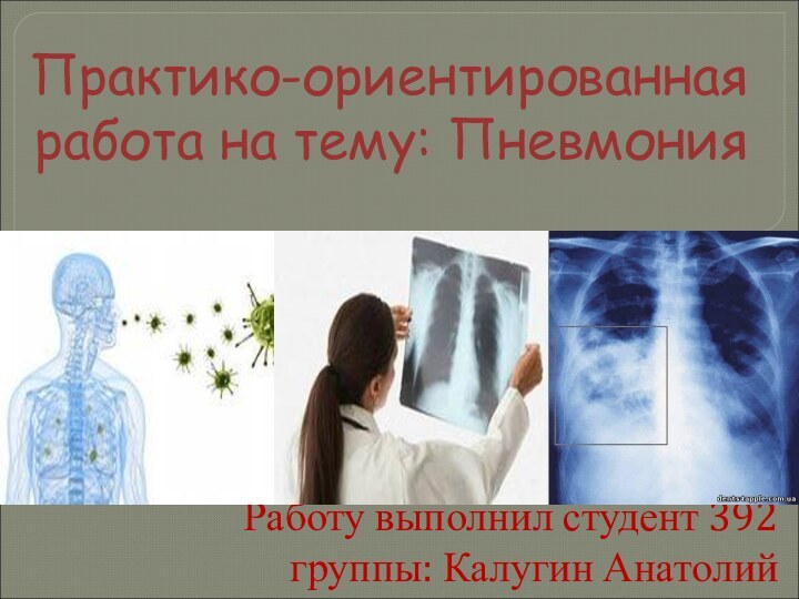 Практико-ориентированная работа на тему: ПневмонияРаботу выполнил студент 392 группы: Калугин Анатолий
