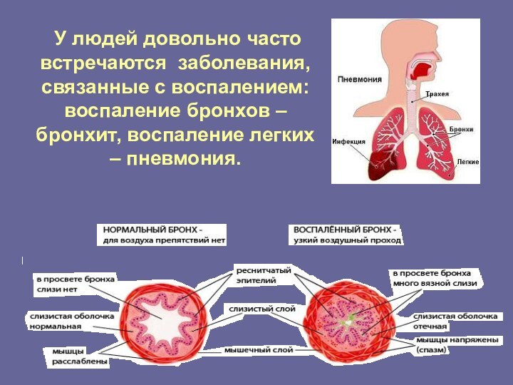 У людей довольно часто встречаются заболевания, связанные с воспалением: воспаление бронхов