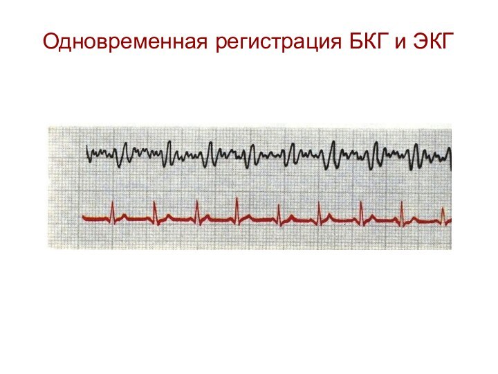 Одновременная регистрация БКГ и ЭКГ