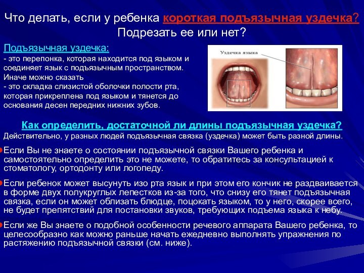 Что делать, если у ребенка короткая подъязычная уздечка? Подрезать ее или нет?Подъязычная