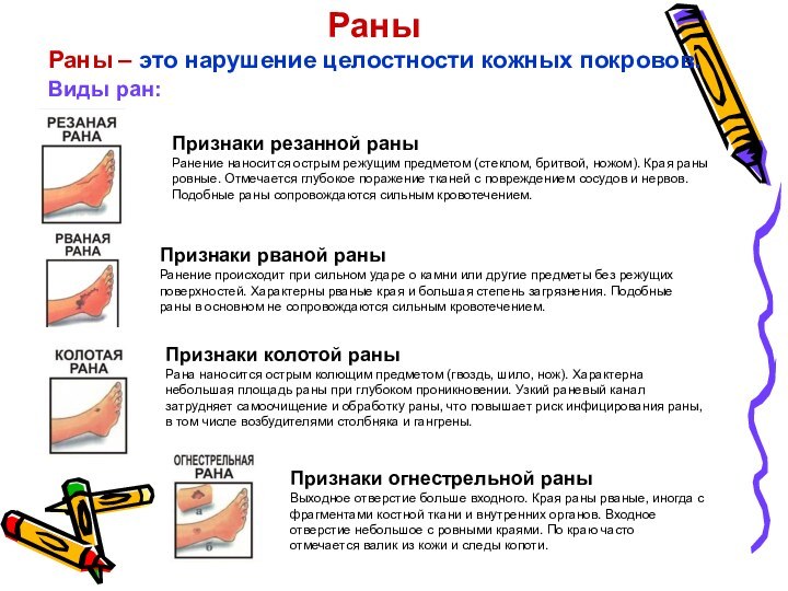 Ответы на тест открытая рана голени. Колото резаная рана описание.