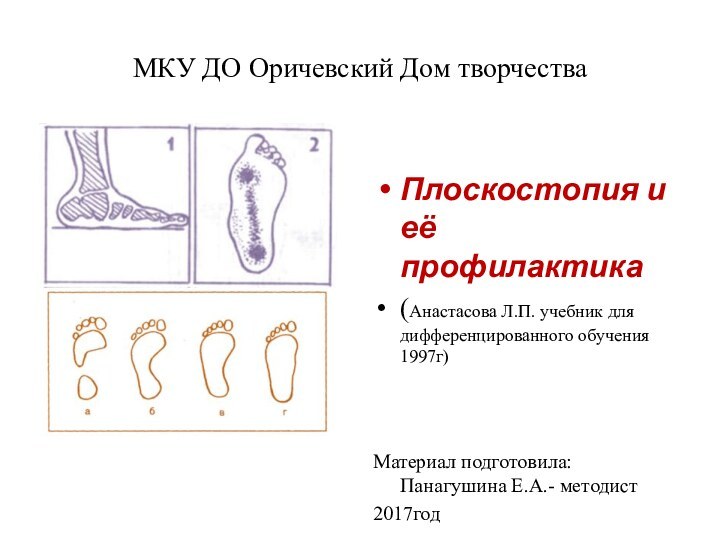 МКУ ДО Оричевский Дом творчестваПлоскостопия и её профилактика(Анастасова Л.П. учебник для дифференцированного