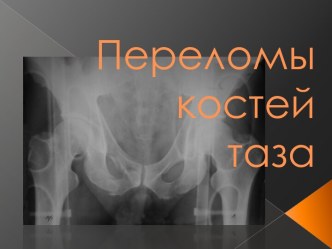 Переломы костей таза