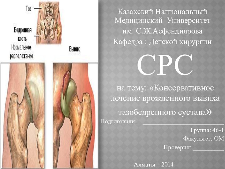 СРС  на тему: «Консервативное лечение врожденного вывиха тазобедренного сустава»Казахский Национальный Медицинский