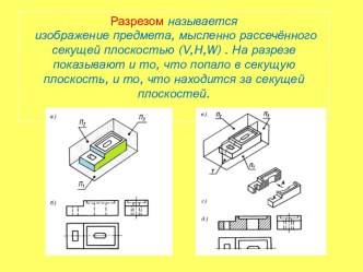 Фронтальный разрез