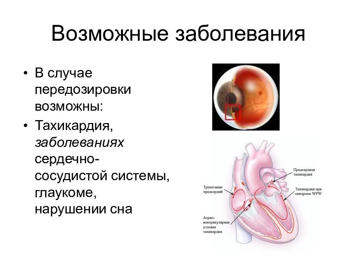 Возможные заболеванияВ случае передозировки возможны: Тахикардия, заболеваниях сердечно-сосудистой системы, глаукоме, нарушении сна