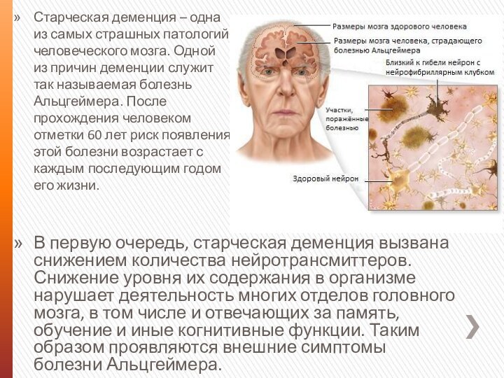 Старческая деменция – одна из самых страшных патологий человеческого мозга. Одной из
