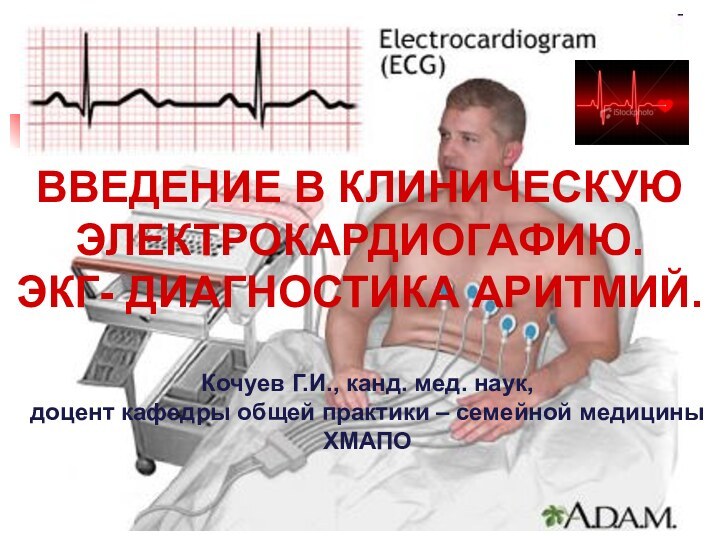 ВВЕДЕНИЕ В КЛИНИЧЕСКУЮ ЭЛЕКТРОКАРДИОГАФИЮ.ЭКГ- ДИАГНОСТИКА АРИТМИЙ.Кочуев Г.И., канд. мед. наук,доцент кафедры общей практики – семейной медициныХМАПО