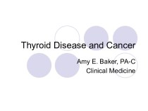 Thyroid disease and cancer