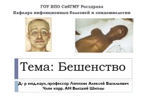 Тема: Бешенство