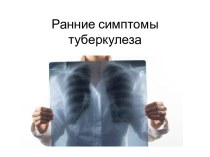 Ранние симптомы туберкулеза