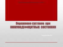 Поражение суставов при иммунодефицитных состояниях