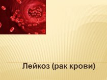 Рак крови (лейкоз)