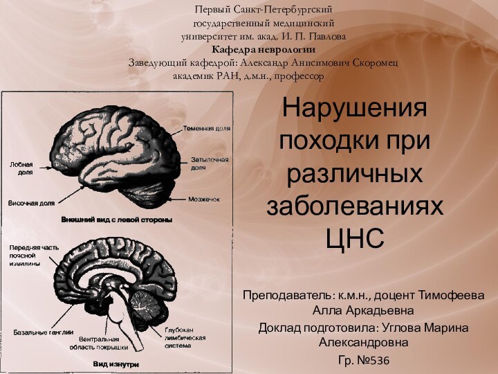 Нарушения походки при различных заболеваниях ЦНСПреподаватель: к.м.н., доцент Тимофеева Алла АркадьевнаДоклад подготовила: