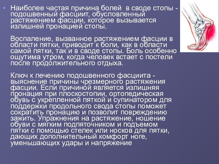 Наиболее частая причина болей в своде стопы - подошвенный фасциит, обусловленный растяжением