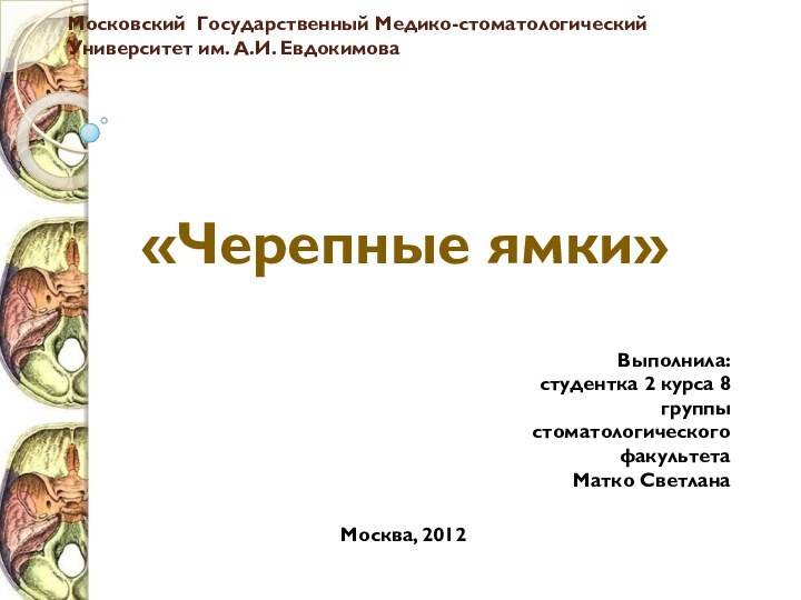 Московский Государственный Медико-стоматологический Университет им. А.И. Евдокимова«Черепные ямки»Выполнила:студентка 2 курса 8 группыстоматологического факультетаМатко СветланаМосква, 2012