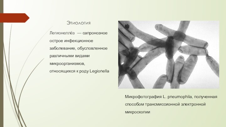 ЭтиологияЛегионеллёз  — сапронозное острое инфекционное заболевание, обусловленное различными видами микроорганизмов, относящихся