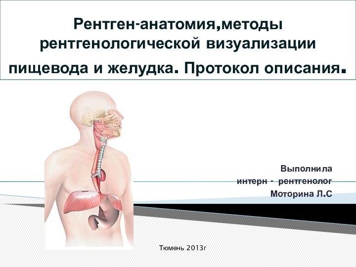 Рентген-анатомия,методы рентгенологической визуализации пищевода и желудка. Протокол описания.Выполнила интерн - рентгенологМоторина Л.СТюмень 2013г