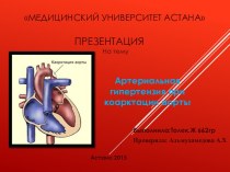 Артериальная гипертензия при коарктации аорты