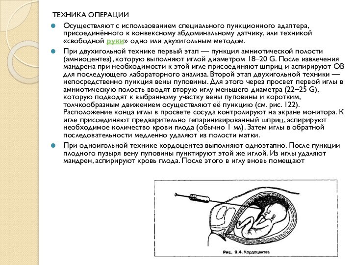 ТЕХНИКА ОПЕРАЦИИОсуществляют с использованием специального пункционного адаптера, присоединённого к конвексному абдоминальному датчику,