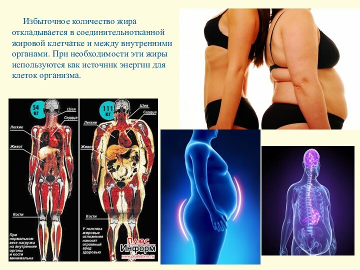 Избыточное количество жира откладывается в соединительнотканной жировой клетчатке и