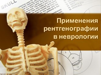 Применения рентгенографии в неврологии