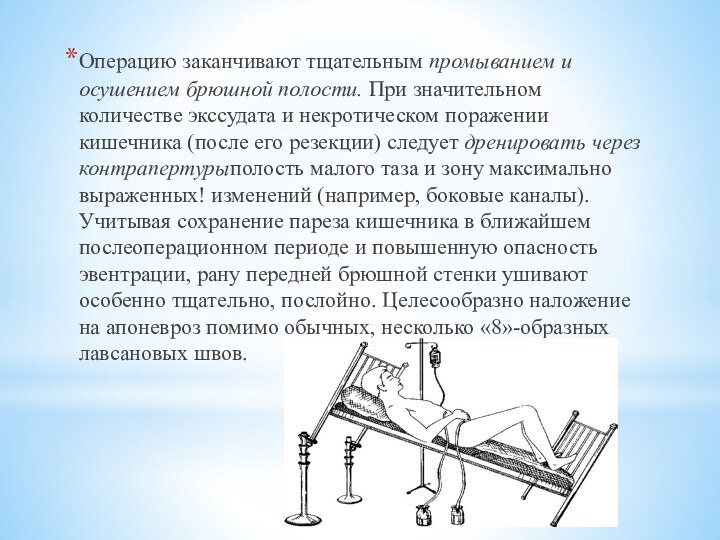 Операцию заканчивают тщательным промыванием и осушением брюш­ной полости. При значительном количестве экссудата и некротическом