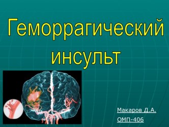 Геморрагический инсульт