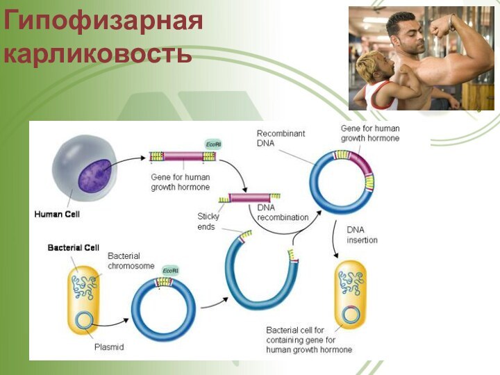 Гипофизарная карликовость