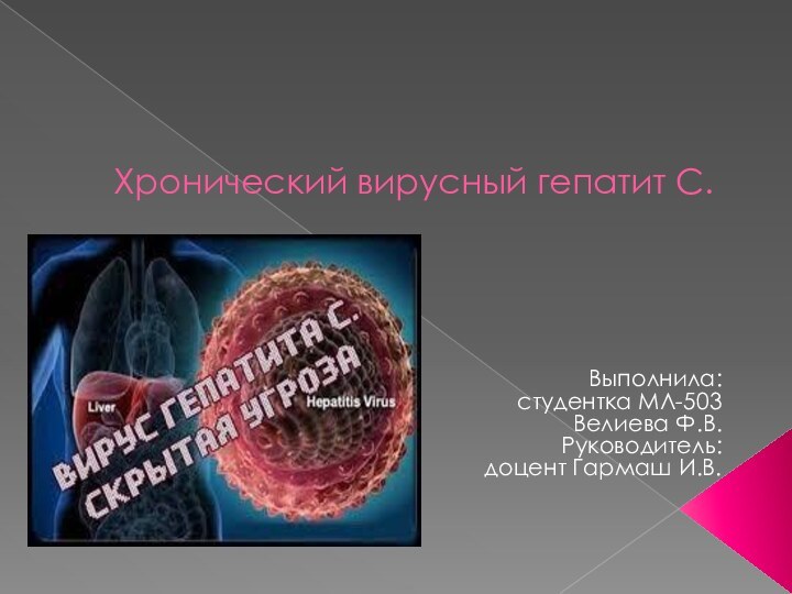 Хронический вирусный гепатит С.  Выполнила: студентка МЛ-503 Велиева Ф.В.Руководитель: доцент Гармаш И.В.