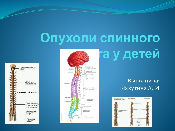 Опухоли спинного мозга у детейВыполнила:Лякутина А. И