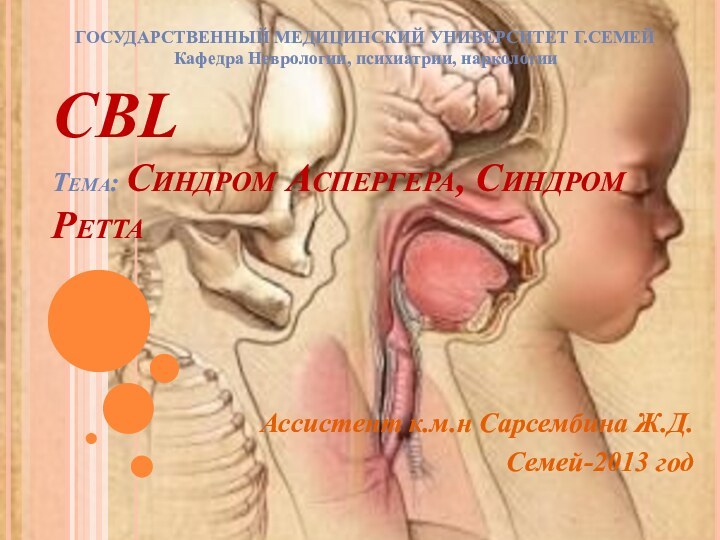 СBL  Тема: Синдром Аспергера, Синдром Ретта Ассистент к.м.н Сарсембина Ж.Д.Семей-2013 годГОСУДАРСТВЕННЫЙ