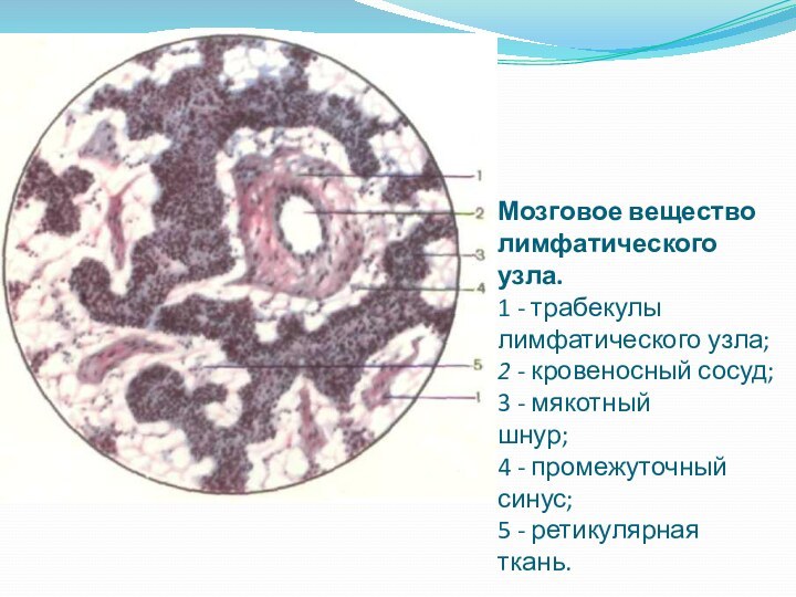 Мозговое вещество лимфатического узла.  1 - трабекулы лимфатического узла; 2 -