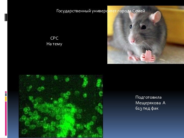 Государственный университет города СемейСРС На темуТуляремияПодготовилаМещерякова А613 пед фак