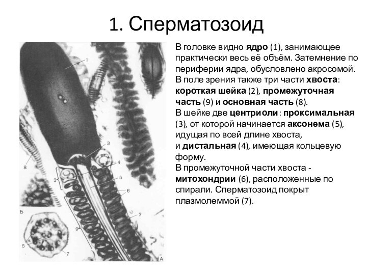 1. СперматозоидВ головке видно ядро (1), занимающее практически весь её объём. Затемнение по периферии