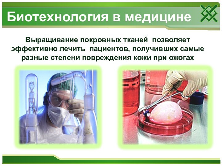 Выращивание покровных тканей позволяет эффективно лечить пациентов, получивших самые разные степени повреждения