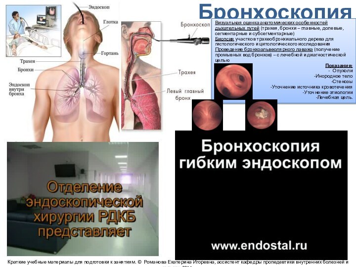 Бронхоскопия Визуальная оценка анатомических особенностей дыхательных путей (трахея, бронхи – главные, долевые,