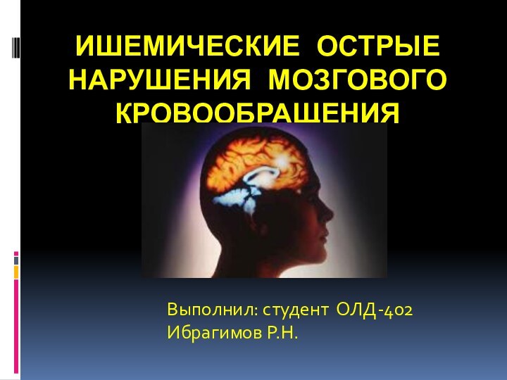 Ишемические острые нарушения мозгового кровообращенияВыполнил: студент ОЛД-402 Ибрагимов Р.Н.