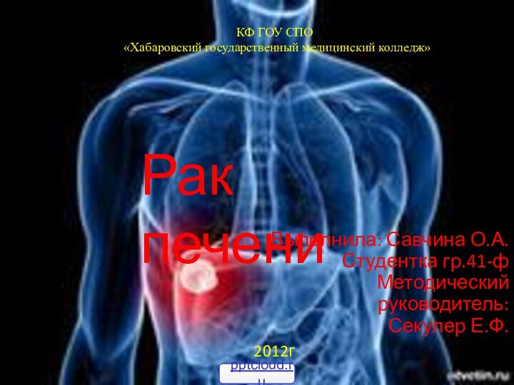 Рак печениВыполнила: Савчина О.А.Студентка гр.41-фМетодический руководитель:Секулер Е.Ф.