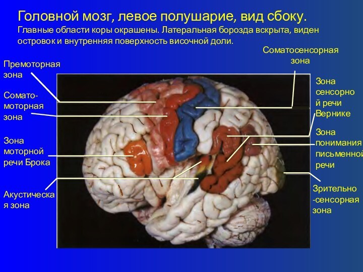 Головной мозг, левое полушарие, вид сбоку. Главные области коры окрашены. Латеральная борозда