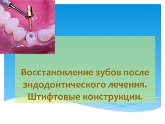 Восстановление зубов после эндодонтического лечения. Штифтовые конструкции.