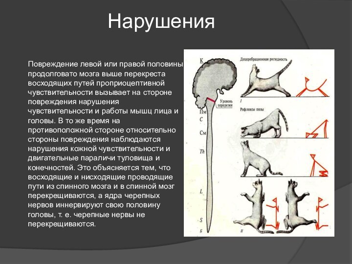 Нарушения Повреждение левой или правой половины продолговато мозга выше перекреста восходящих путей