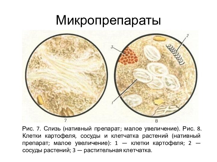 Микропрепараты	 Рис. 7. Слизь (нативный препарат; малое увеличение). Рис. 8. Клетки картофеля,